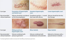 Load image into Gallery viewer, Gel Scar Therapy Patch