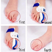 Load image into Gallery viewer, Bunion Corrector